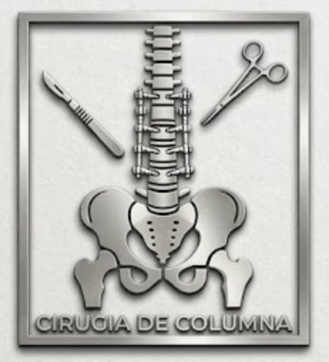 Cirugía de Columna