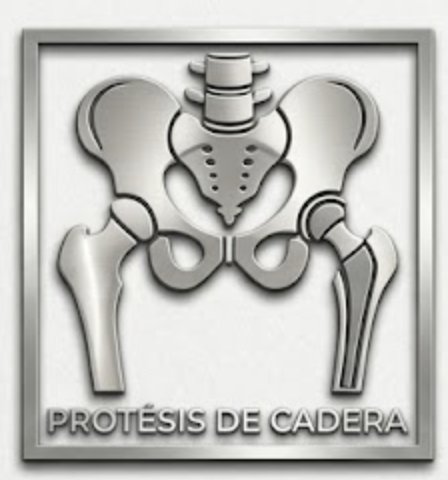 Prótesis Articular